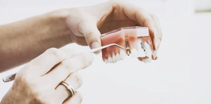 Odontologia nos EUA: Conheça o NBDE