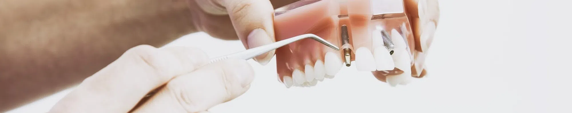 Odontologia nos EUA: Conheça o NBDE