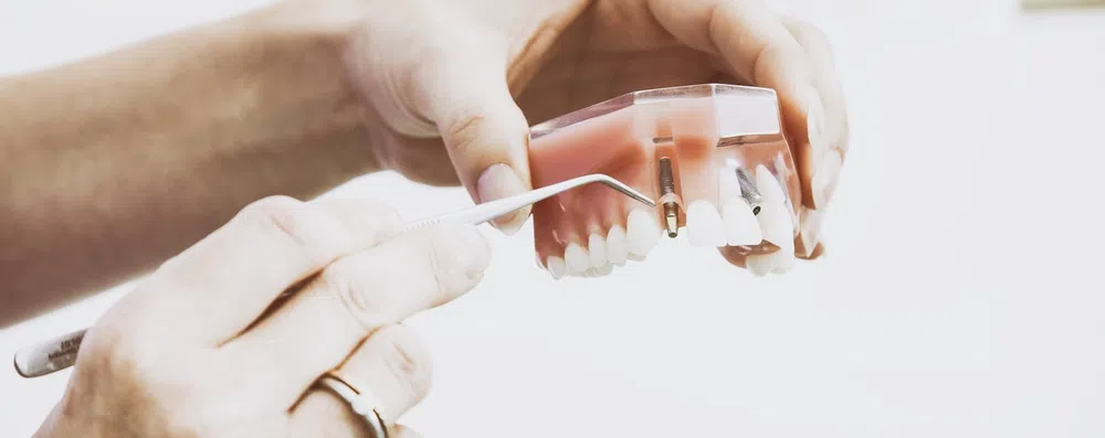 Odontologia nos EUA: Conheça o NBDE